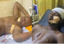 Upper West Region: Policemen Assaulted in Jirapa; AK-47 Rifles Reported Missing Upper West Region: Policemen Assaulted in Jirapa; AK-47 Rifles Reported Missing