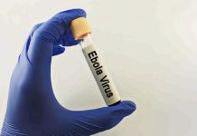 Health Ministry Urges Vigilance After WHO Declares Ebola Outbreak Global Health Emergency Health Ministry Urges Vigilance After WHO Declares Ebola Outbreak Global Health Emergency