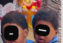 DNA Results Reveal Twins With Different Fathers DNA Results Reveal Twins With Different Fathers